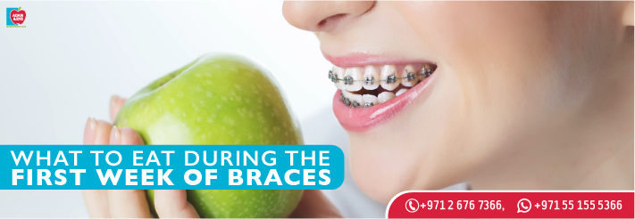 Foods to Eat and to Avoid During the First Week of Having Braces 